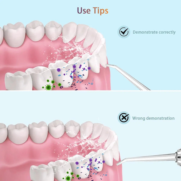Smart Smile Water Flosser